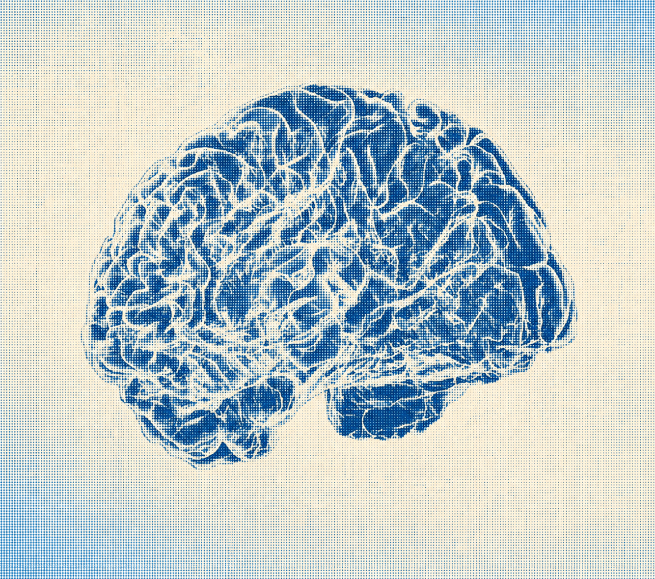 A brain in the Sentry halftone treatment